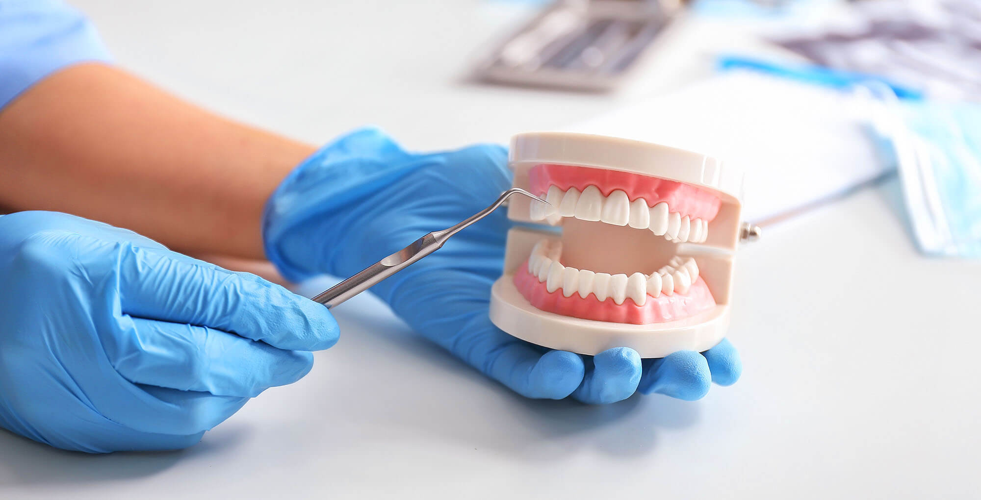 Ein Paar Hände in blauen medizinischen Handschuhen hält ein Gebissmodell und ein zahnärztliches Instrument (einen zahnärztlichen Sonde oder Explorer). Im Hintergrund sind weitere zahnmedizinische Utensilien und Masken angedeutet. Die Szene könnte in einer Zahnarztpraxis in Saarbrücken aufgenommen worden sein und die Vorbereitung einer Behandlung oder eine Erläuterung veranschaulichen.